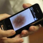 O DermoScreen é uma criação de George Zouridakis, um professor da Universidade de Houston, que consiste em detectar a presença do melanoma, a forma mais ameaçadora do câncer de pele.